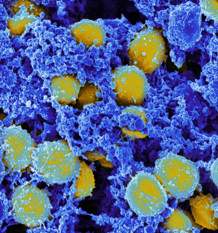 Staphylococcus aureus bacteria yellow purple blue