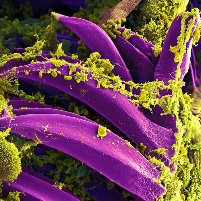 yersinia pestis bacteria bubonic plague